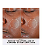 Shark FW312UKPK CryoGlow Under-Eye Cooling + LED Anti-Ageing & Blemish Repair Mask - Spa Pink | Skin Care | Health & Beauty | Home & Outdoor | Catalogue | Euronics Site